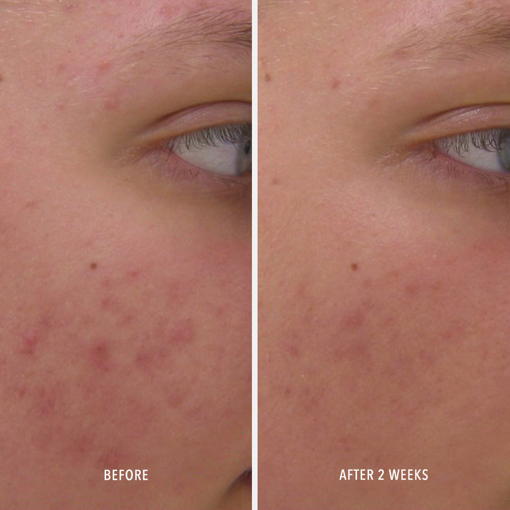 Clear Rescue Serum