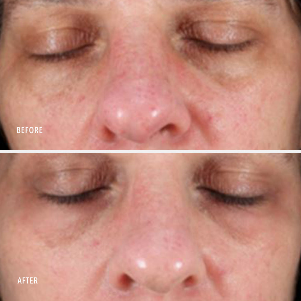 Travel Collagen ReActivate PM