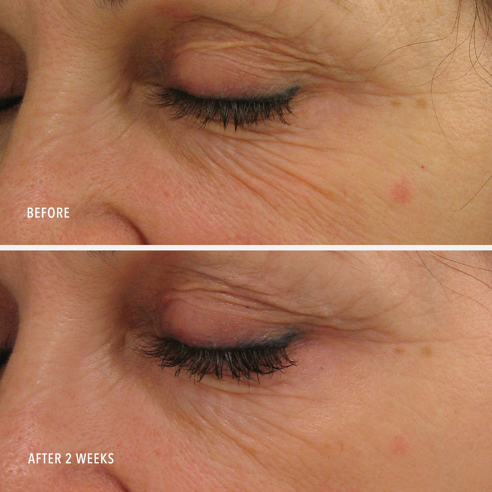 Travel-Size Power Serum