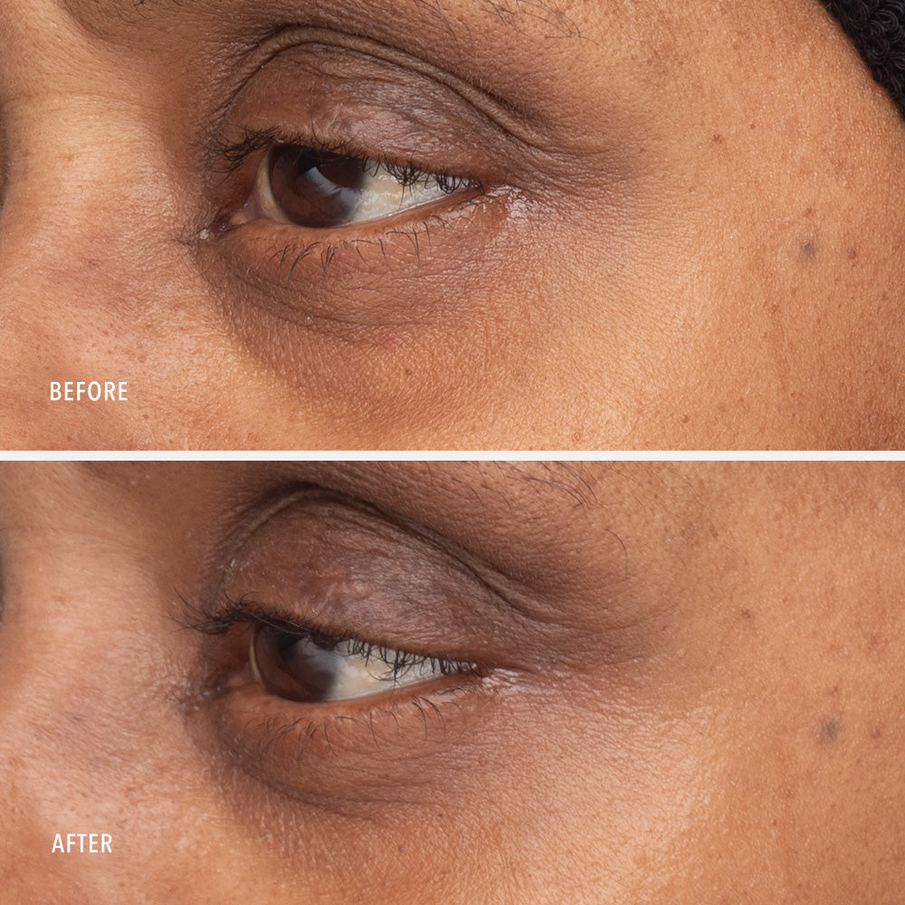 Travel-Size Retinol Eye Renewal