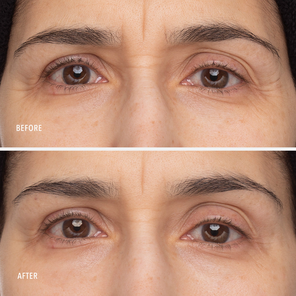 Travel-Size Retinol Eye Renewal