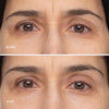 Travel-Size Retinol Eye Renewal