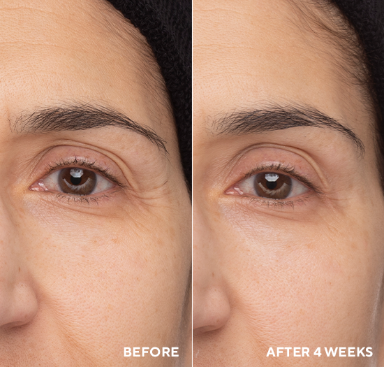 Retinol Eye Renewal