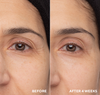 Retinol Eye Renewal